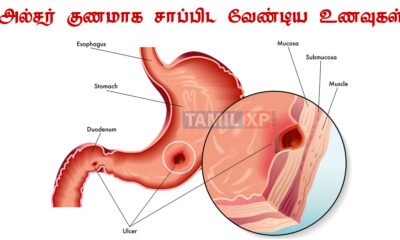 ulcer treatment in tamil